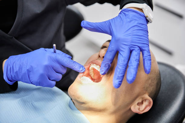 Best Emergency Treatment for Dental Infections or Abscesses in Abbeville, LA