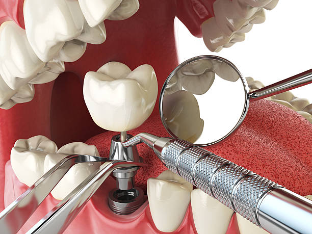 Best Same-Day Emergency Dental Services in Abbeville, LA